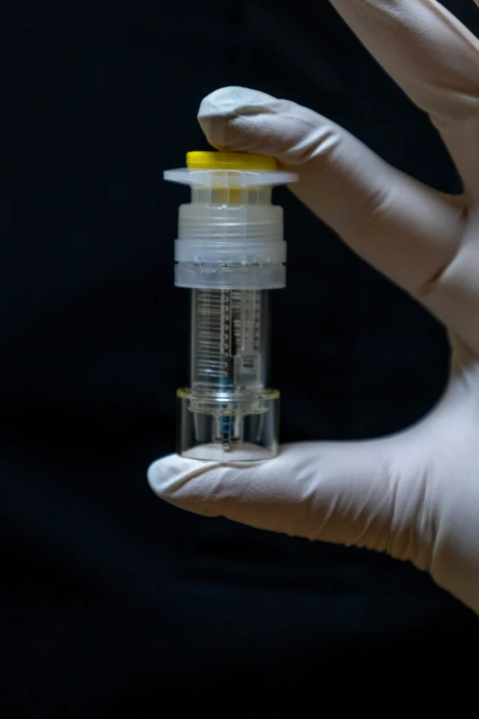 Impianti Dentali Fissi per un Nuovo Sorriso