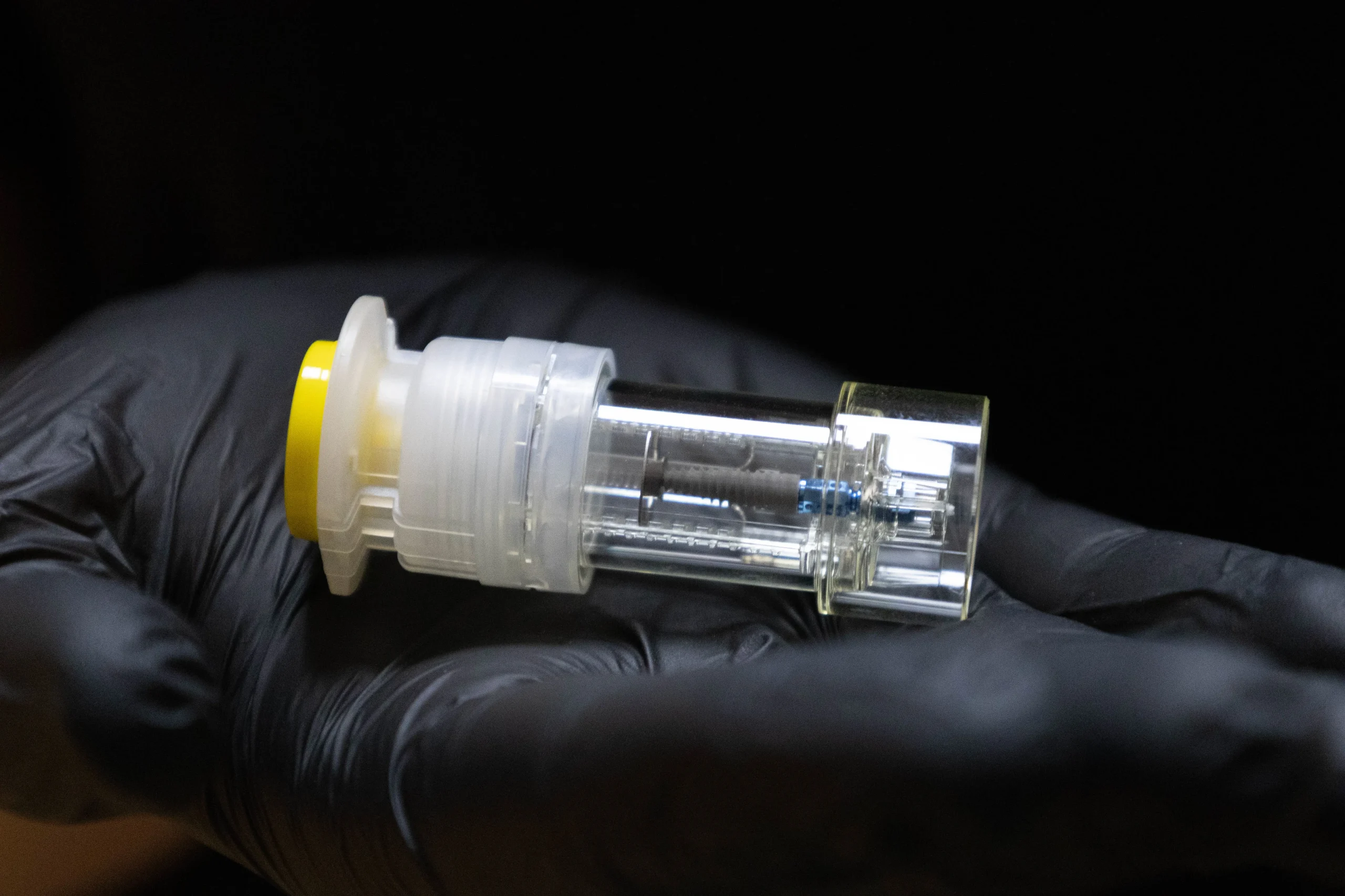 Implante dentare fikse për një buzëqeshje të re